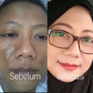 Perawatan wajah